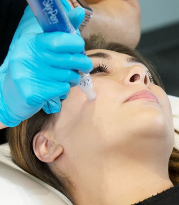 Chemical Peels and Skin Care